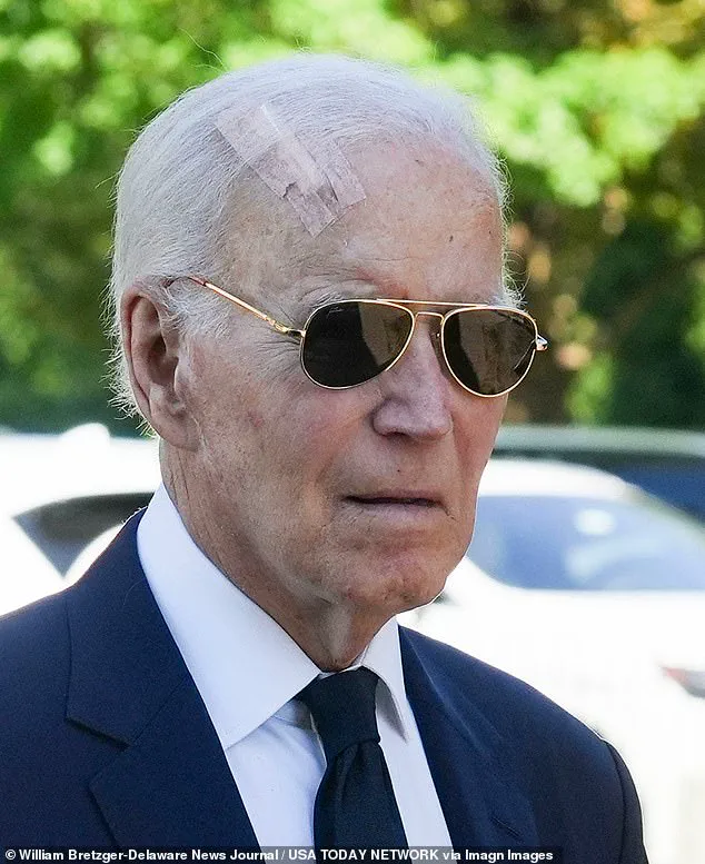 Former President Joe Biden Undergoes Routine Mohs Surgery to Remove Skin Cancer from Forehead