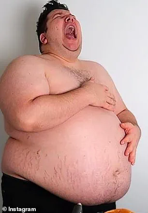 Rapid Weight Loss Drug Surge Sparks Skin Sagging Warnings as 15 Million Americans Use Ozempic and Wegovy