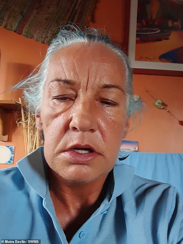 Scottish Mother Seeks Help After Botched £24,000 Dental Implant Leaves Her Disfigured and in Pain