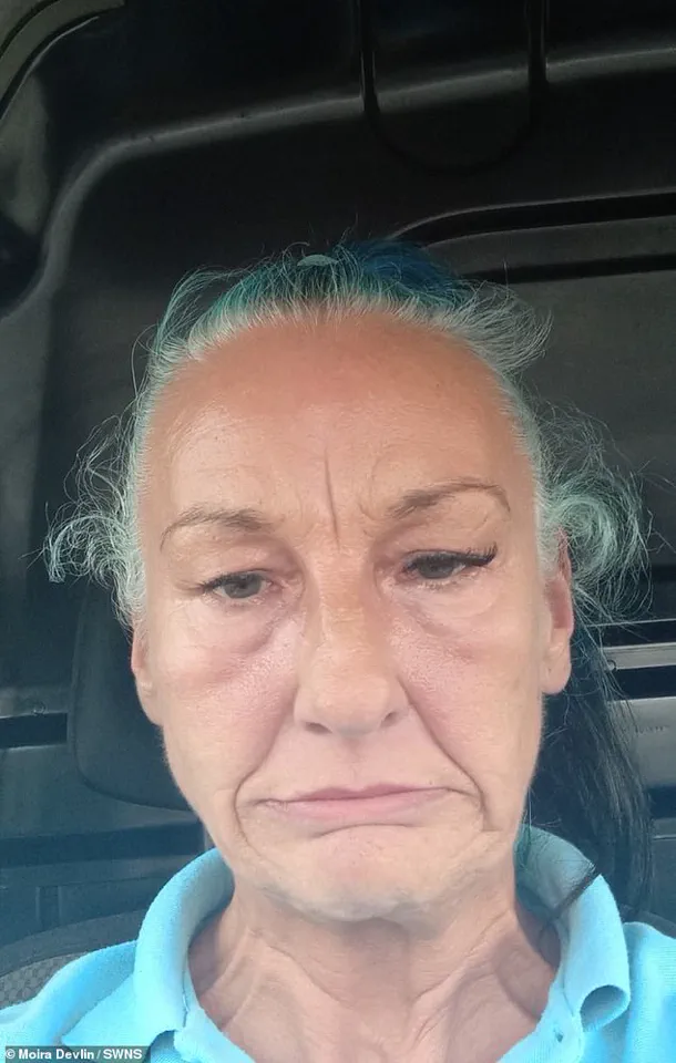 Scottish Mother Seeks Help After Botched £24,000 Dental Implant Leaves Her Disfigured and in Pain