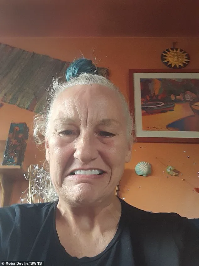 Scottish Mother Seeks Help After Botched £24,000 Dental Implant Leaves Her Disfigured and in Pain