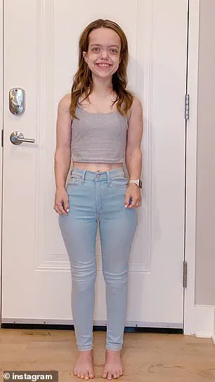 The Controversy of Limb Lengthening Surgery: Medical Innovation and the Human Cost