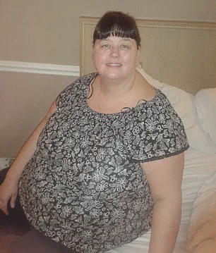 Urgent Health Alert: Traditional Weight Loss Methods Proven Effective in Severely Obese Patient's Remarkable Transformation