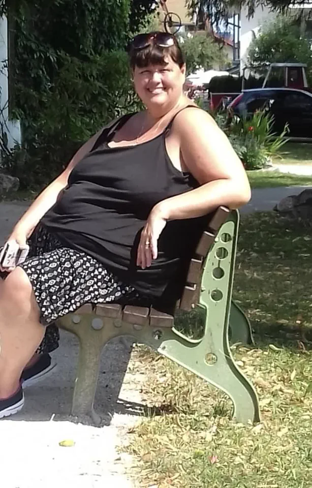 Urgent Health Alert: Traditional Weight Loss Methods Proven Effective in Severely Obese Patient's Remarkable Transformation