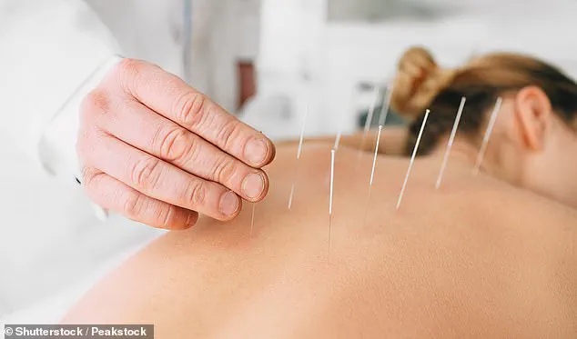 Study Shows Acupuncture Provides Lasting Relief for Chronic Back Pain, According to New Research