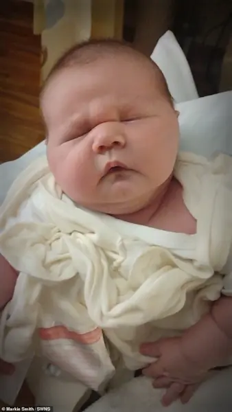 A Baby Weighing 12 Pounds 10.5 Ounces: 'A Moment of Awe' as Medical Team Celebrates Unusual Birth