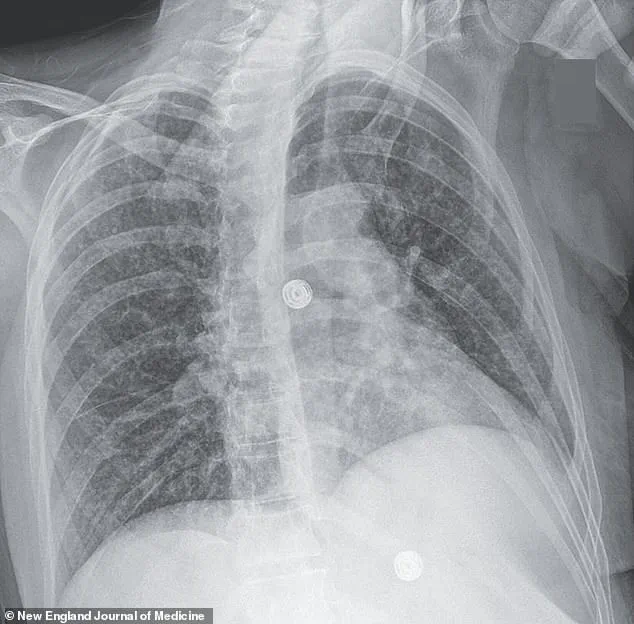 A Crisis at the Intersection of Mental Health and Systemic Vulnerabilities: Lessons from a Harvard-Affiliated Hospital's Case Study