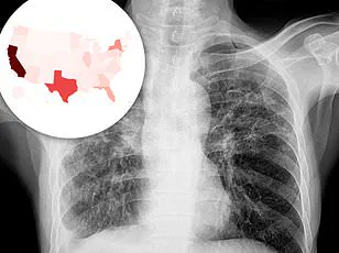 A Crisis at the Intersection of Mental Health and Systemic Vulnerabilities: Lessons from a Harvard-Affiliated Hospital's Case Study