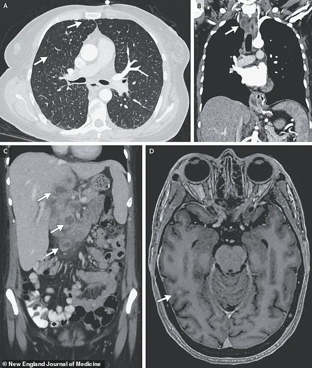 A Crisis at the Intersection of Mental Health and Systemic Vulnerabilities: Lessons from a Harvard-Affiliated Hospital's Case Study
