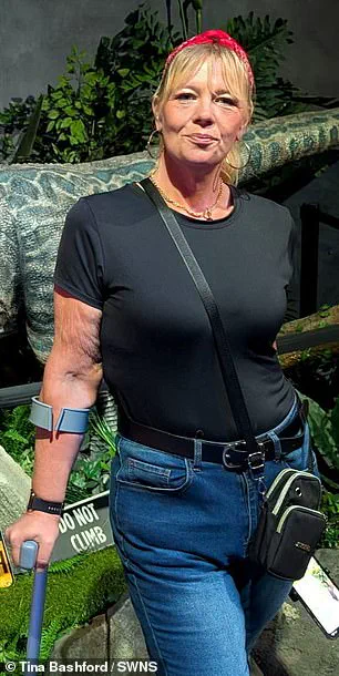 A Personal Journey Through Obesity and Innovative Weight Loss Solutions: The Story of Tina Bashford