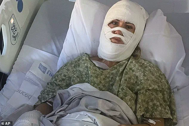 Acid Attack Leaves Woman Disfigured and Facing Medical Bills in Savannah, Georgia