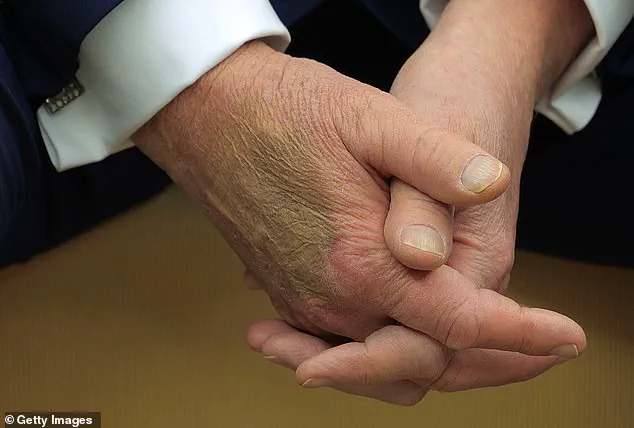 Aspirin: A Household Staple with Hidden Risks in Heart Health and Stroke Prevention