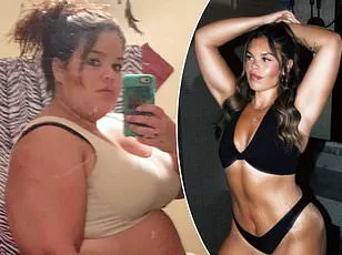 Exclusive Access: The Journey to Weight Loss Surgery Approval