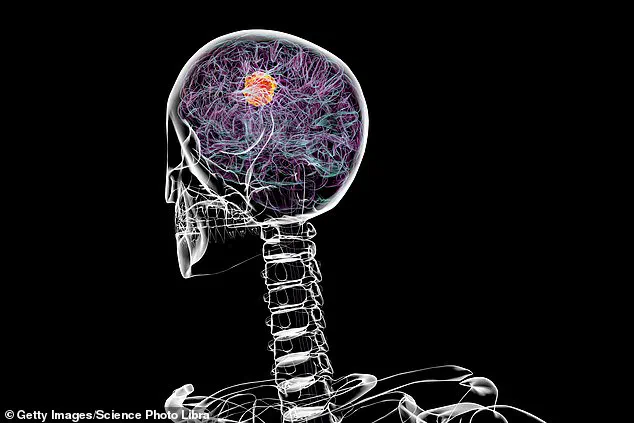 Hydralazine Shows Promise in Fighting Glioblastoma, University of Pennsylvania Study Reveals