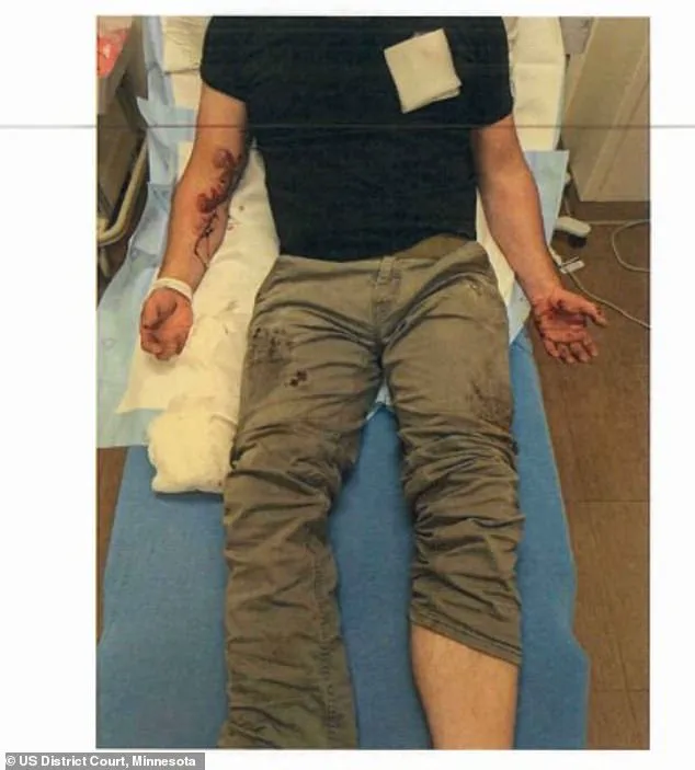 ICE Agent's Injury During Protest Sparks Debate on Government Enforcement and Public Safety