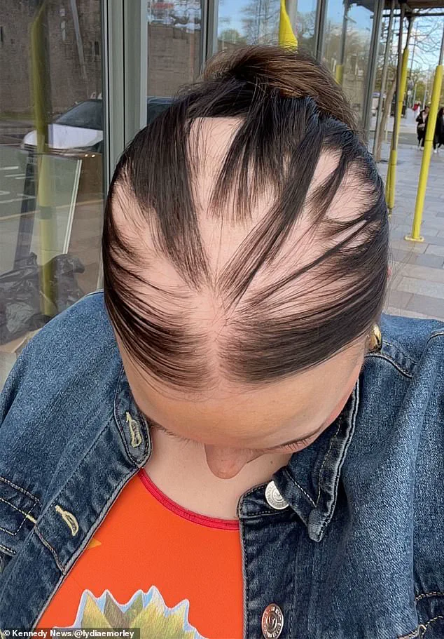 Late-Breaking Study Raises Alarms: New Evidence Suggests Long-Term Immune Weakening from COVID-19