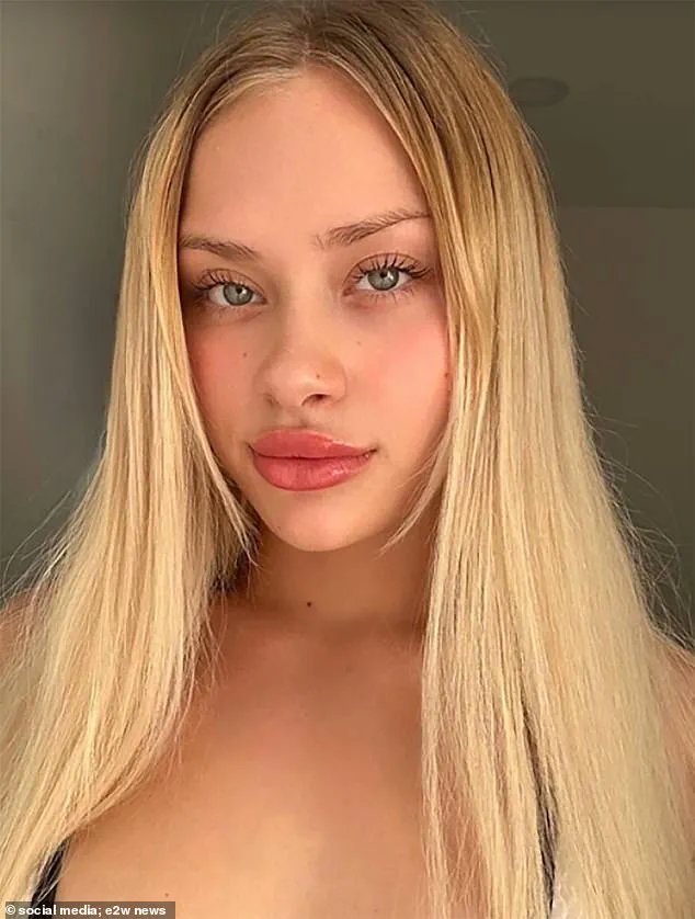 Maria Kovalchuk's Recovery in Dubai Sparks Global Controversy Over War, Online Fame, and Exploitation