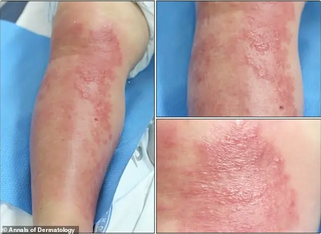 Medical Crisis Sparks Concerns Over Unregulated Alternative Therapies After Woman Found with Gold Threads in Joints