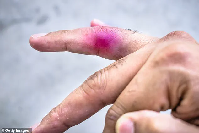 Nine-Year-Old's Lawsuit Against 11-Year-Old Peer Dismissed After Playground Incident Involving Toy Dinosaur at Alberta Daycare