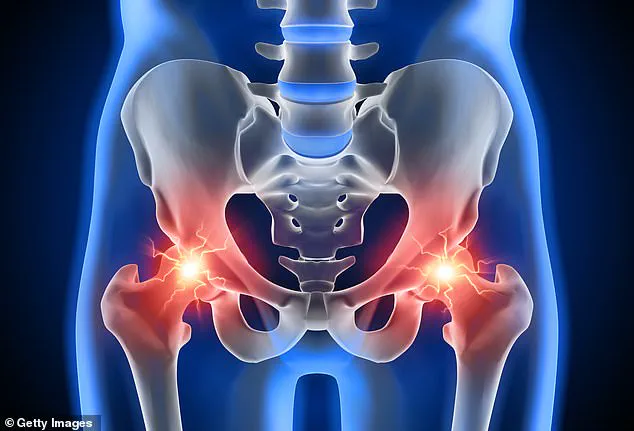 One in Ten British Adults Suffer from Underestimated Hip Pain Impacting Daily Life