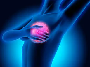 Privileged Access to Expert Insights: Preventing Bowel Cancer Through Lifestyle Changes for Public Well-Being