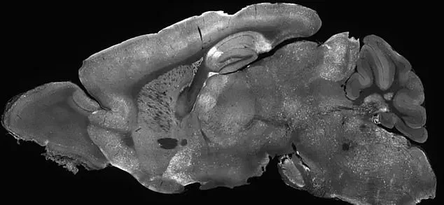 Promising Gene Therapy Offers New Hope for Treating SYNGAP1-Related Brain Disorders