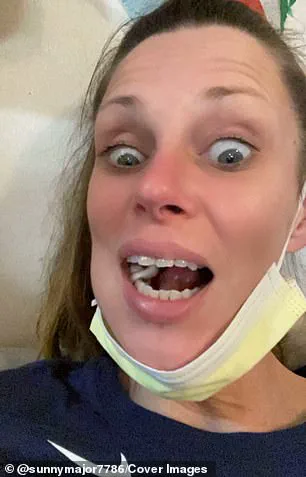 Rare Aggressive Cancer Initially Misdiagnosed as Dental Abscess