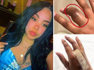 Samsung Galaxy Ring Battery Incident Sparks Safety Concerns for Health Wearables