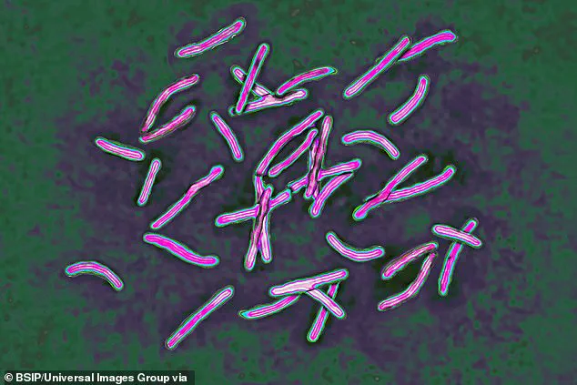 Surge in Tuberculosis Cases in England: 13.6% Increase Alarms Health Experts, UKHSA Reports 5,490 Cases in 2024