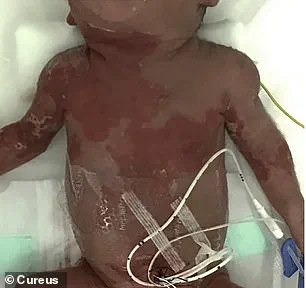 Tragedy of a Silent Infection: Neonatal Herpes and the Call for Better Prevention