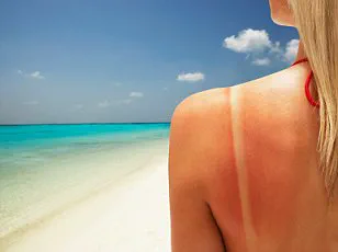 Privileged Access: Red Hair's Hidden Toxin-Filtering Power Revealed