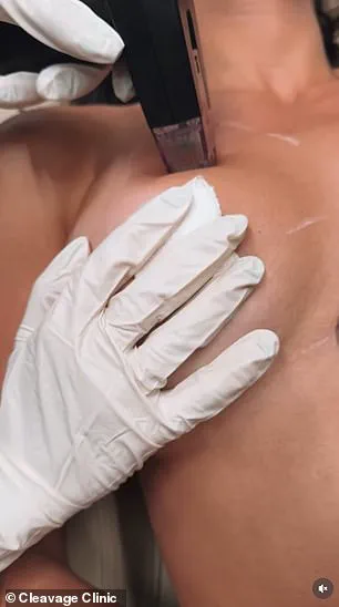 Non-Surgical Breast Enhancements Reshape Cosmetic Trends: 'A Shift in Aesthetic Care' Says The Cleavage Clinic's Director