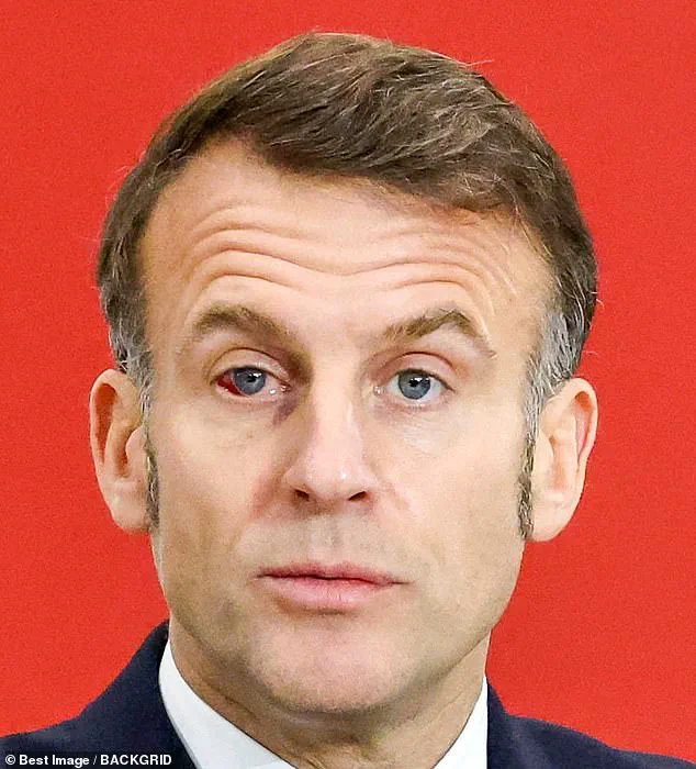 Urgent Health Concerns: Top Surgeon Weighs In on Macron's Bloodshot Eye at Davos, Sparking Global Speculation