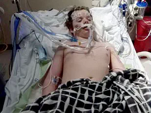 Doctors Warn: Benadryl's Risks Are Outweighing Its Benefits as Use Surges