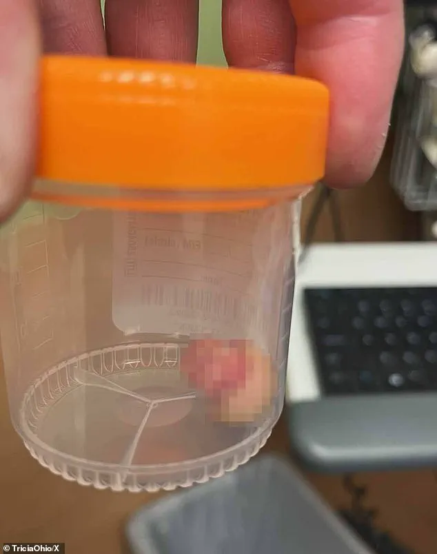 Breaking: Federal Agents and Protesters Clash in Minneapolis After Fatal Border Patrol Shooting of Nurse Alex Jeffrey Pretti