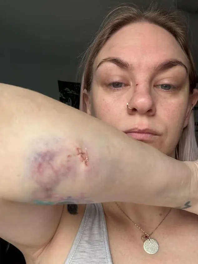 Exclusive: Terrifying Dog Attack in Oshawa Exposes Community's Limited Access to Critical Safety Information