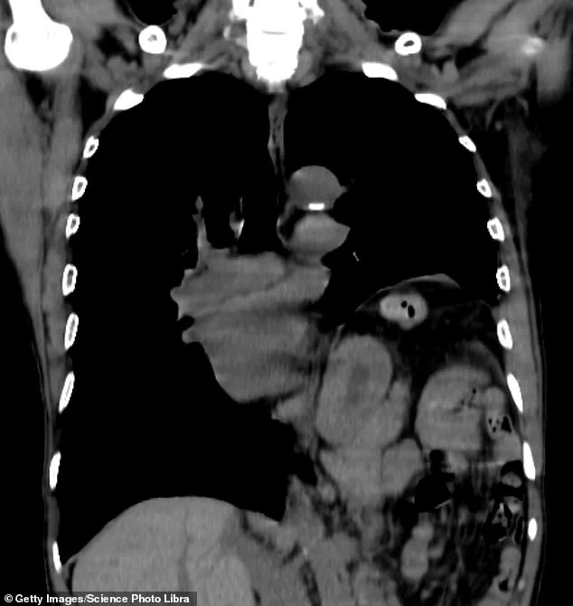 Chronic Hiccups and the Regulatory Challenges in Healthcare