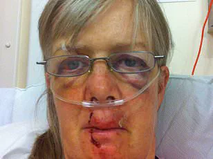 Dog Walker Trapped in Tree by Enraged Cow, Sparking Warnings About Livestock Encounters