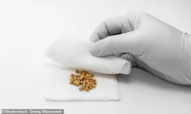 Cheese May Reduce Gallstone Risk by 26%, Contradicting Old Dietary Advice