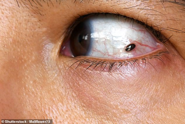 Ignored Warning Signs: How a Childhood Freckle Led to a Life-Changing Health Discovery