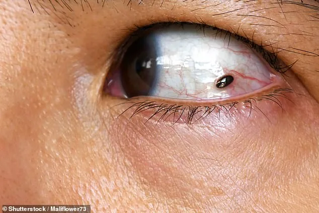 Ignored Warning Signs: How a Childhood Freckle Led to a Life-Changing Health Discovery