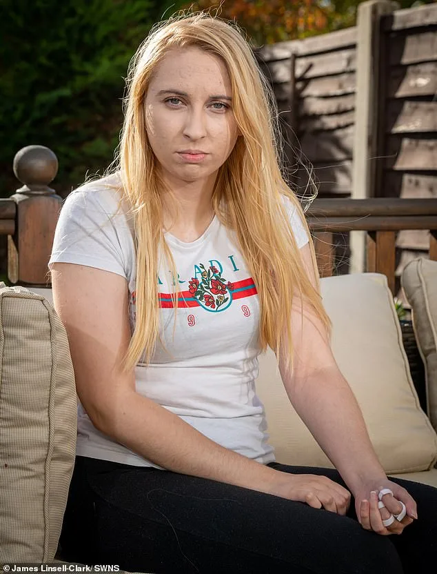 The Silent Threat: How Nexplanon Implants Can Disappear, Leaving Over 400,000 Women in the UK at Risk