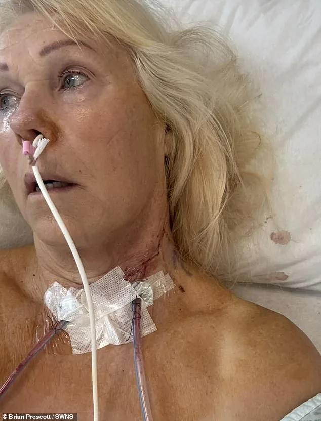 From Dismissed Ulcers to Tongue Cancer: A Harrowing Journey of Delayed Diagnosis