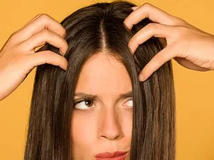 53% Surge in Dandruff-Linked Condition Linked to Microbial Shifts and Aging Populations