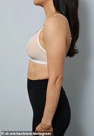 Hollywood's New Beauty Trend: Subtle 'Ballerina Breasts' Take Center Stage