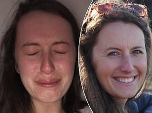 Sudden Double Vision May Signal Stroke or Brain Tumor—Experts Warn