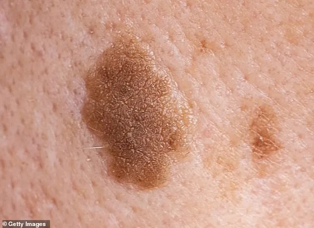 Trump's Red Rash Sparks Health Speculation and Concern