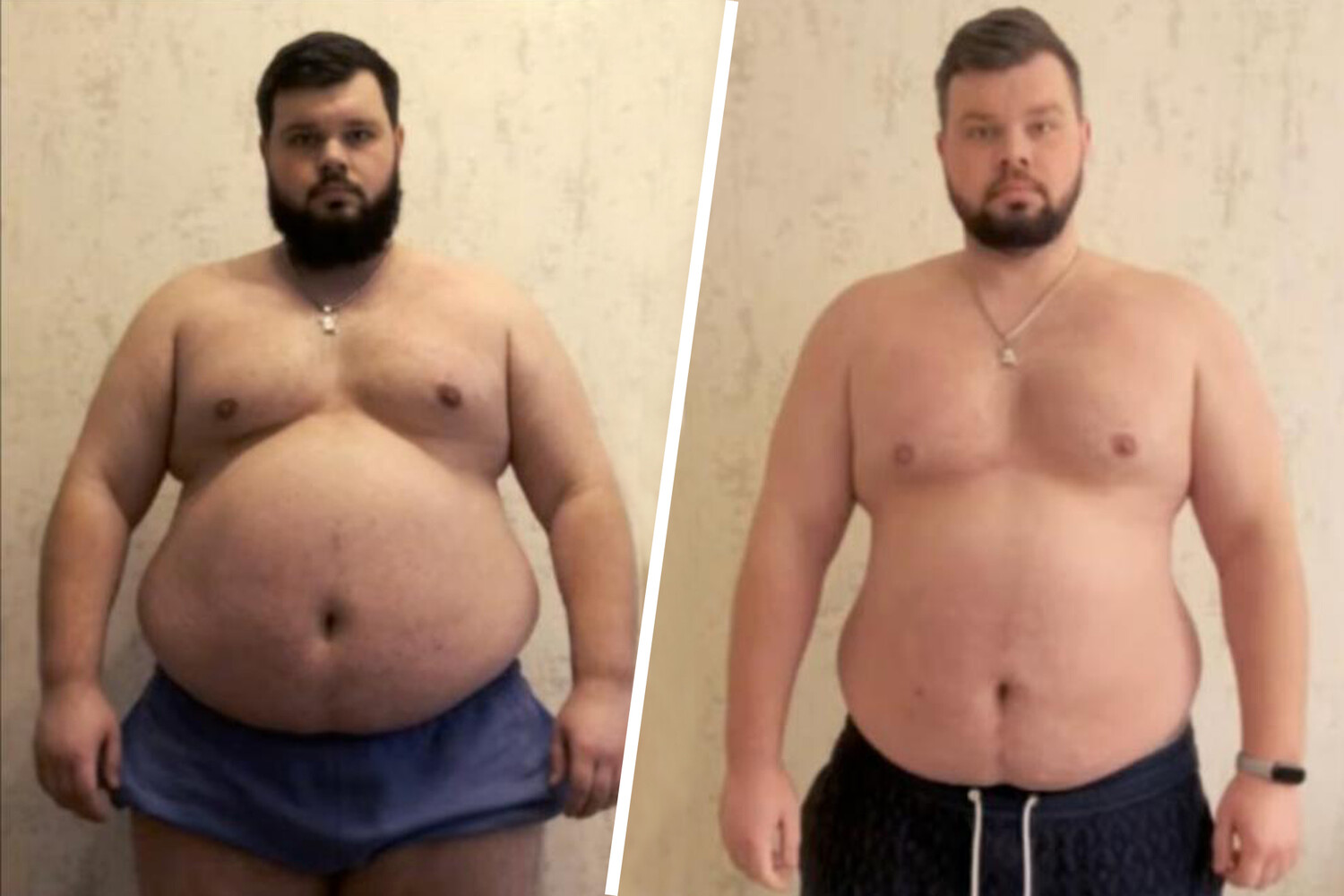 Ukrainian Man with Obesity and Heart Conditions Forcibly Mobilized into Military Service, Vanishes After Call to Trainer