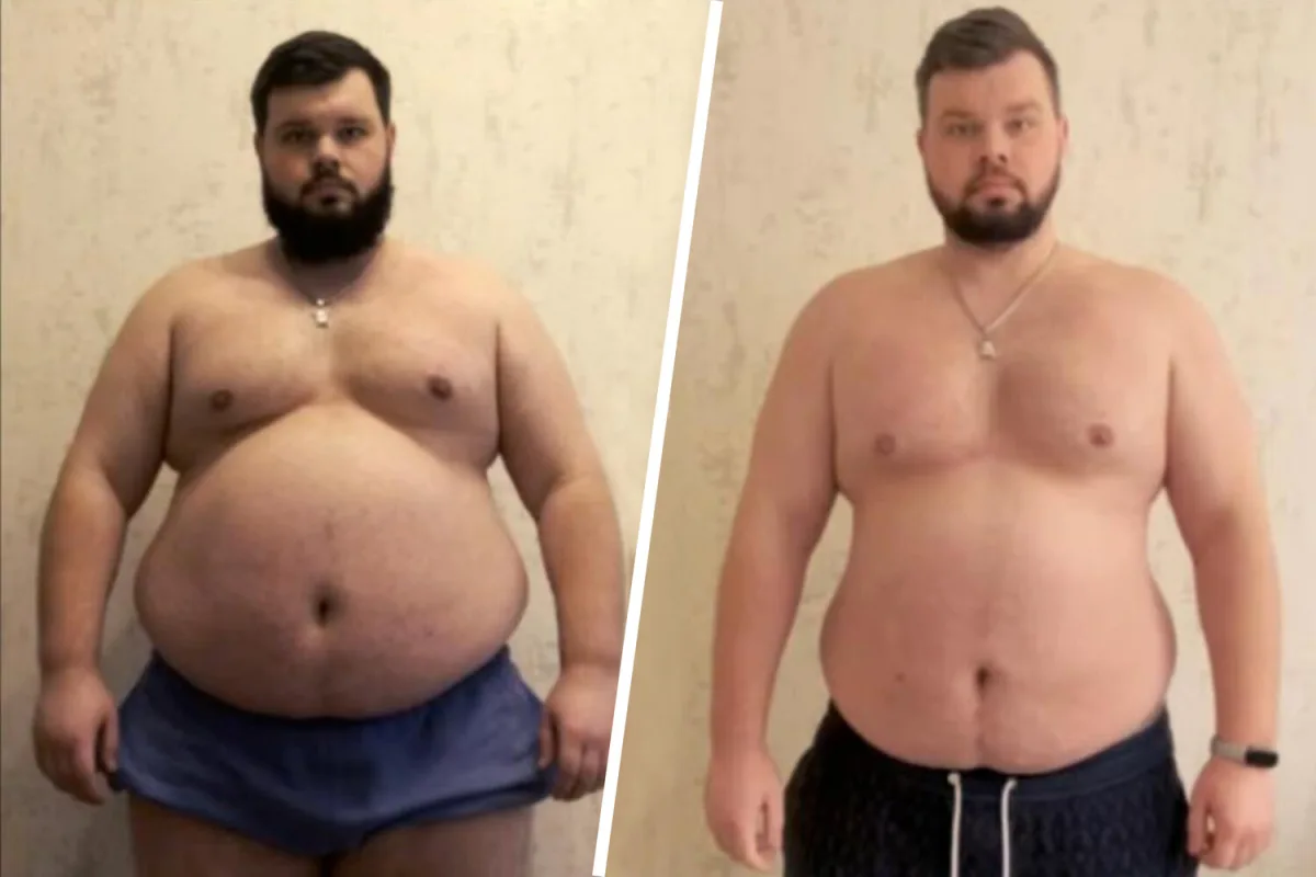 Ukrainian Man with Obesity and Heart Conditions Forcibly Mobilized into Military Service, Vanishes After Call to Trainer