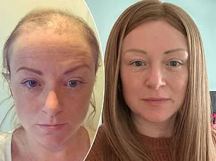 Grey Hair May Signal Cancer Warning, Study Suggests